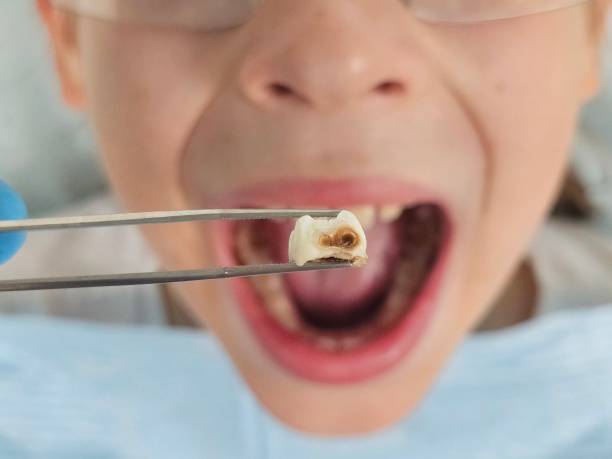 Best Emergency Care for Gum Disease in Lincoln Park, NJ